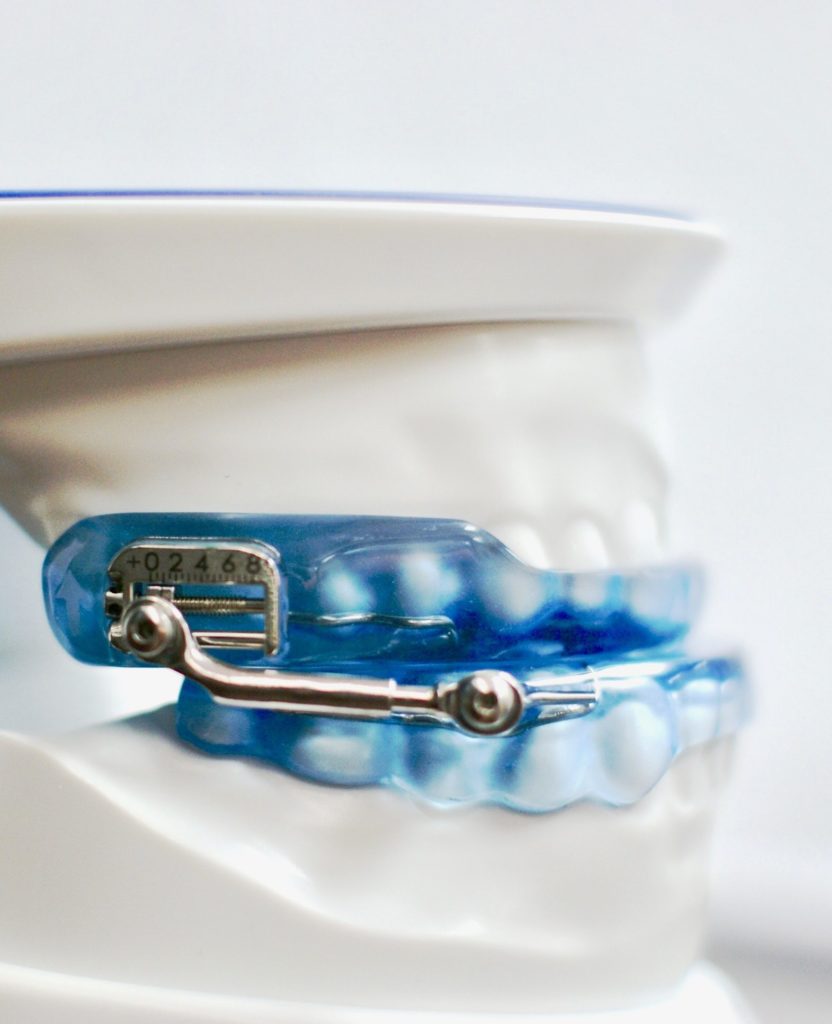 Blue Herbst Sleep Apnea Device