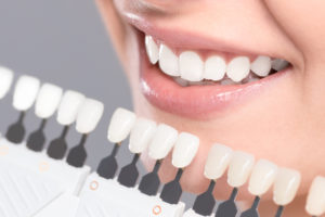 Woman smiling with bright white teeth next to shades of tooth colors at the dental office