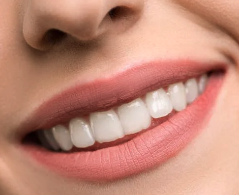 white teeth