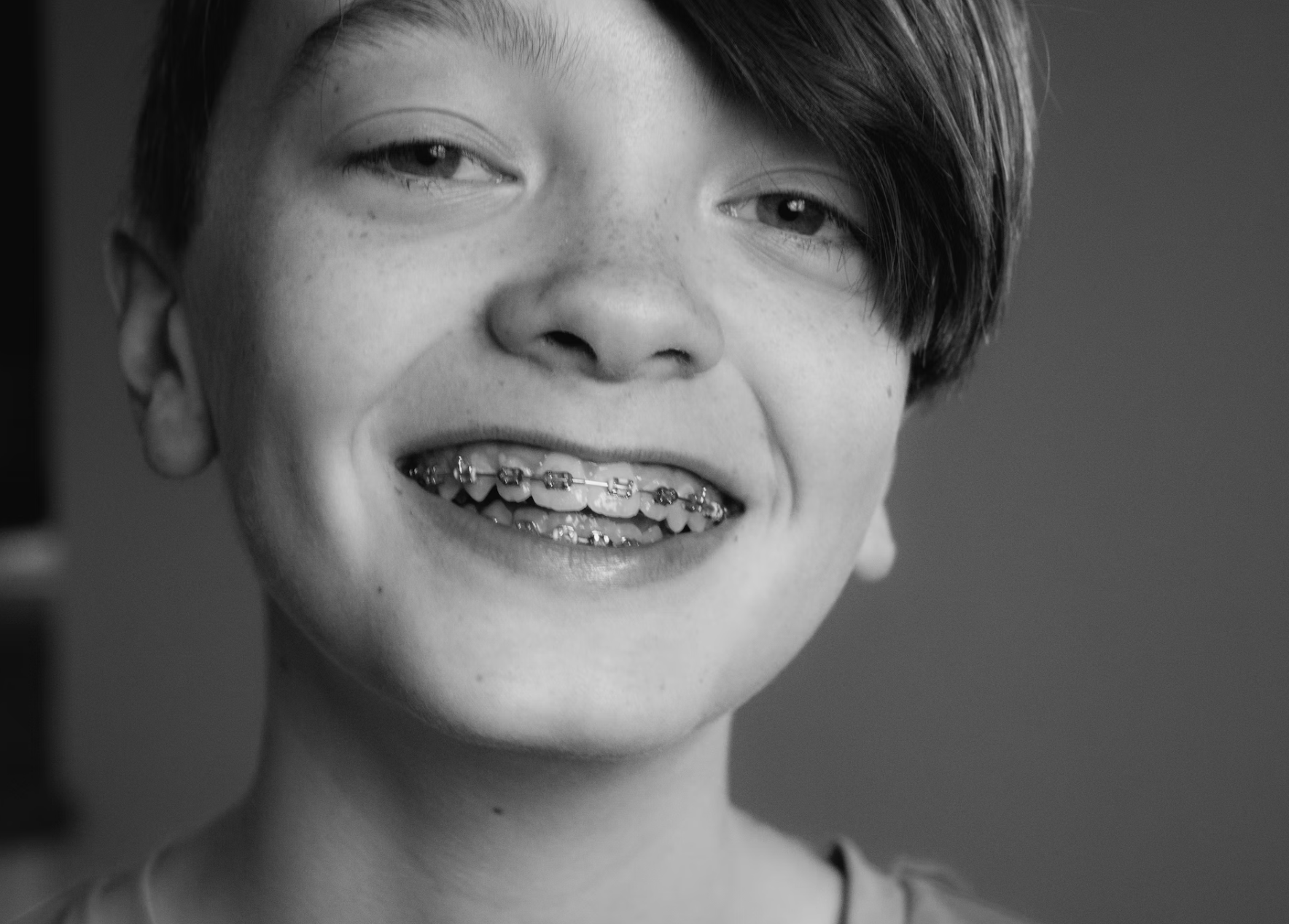 boy with braces smiling black and white