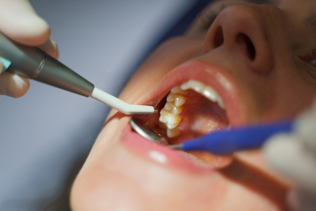 dental exam