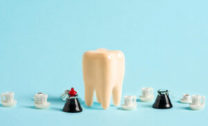 Yellow sick human tooth between coffee pots and coffee cups on blue background. Teeth staining with caffeinated beverages concept. Poster advertising dental clinic.